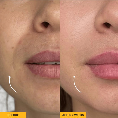 Lymphatic Face Brush